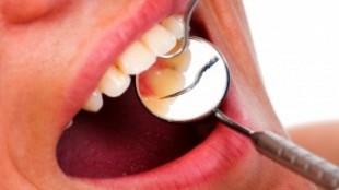 Periodontal Hastalık Nedir?